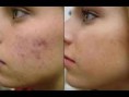 /album/exemple-de-wraps-visages/a1238174-10201420987039459-1660796754-n-jpg/