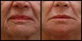 /album/exemple-de-wraps-visages/a1617928-1393333160931781-236283680-o-jpg/